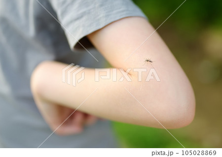 Mosquito sitting on the hand of child. Gnat sucking blood. Danger of bite of an insect. Use repellent for safety kids. Mosquito sitting on the hand of child. Gnat sucking blood. Danger of bite of an insect. Use repellent for safety kids. 105028869