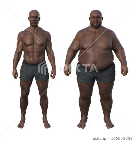 A normal weight African man and the same man in an overweight condition, highlighting the anatomical and physiological differences, 3D illustration A normal weight African man and the same man in an overweight condition, highlighting the anatomical and physiological differences, 3D illustration 105035659