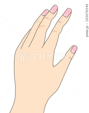 手のトラブル（あかぎれ） 105070540