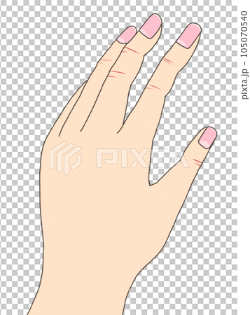 手部問題（乾裂） 105070540