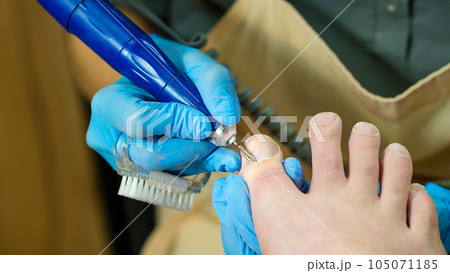 Process hardware pedicure. 105071185