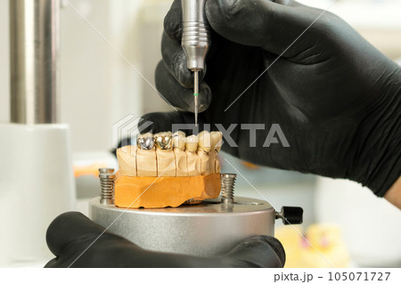 Manufacturing of dental crowns and dentures Manufacturing of dental crowns and dentures 105071727