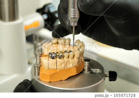 Manufacturing of dental crowns and dentures 105071728