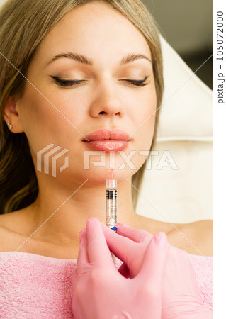 Lip augmentation procedure 105072000