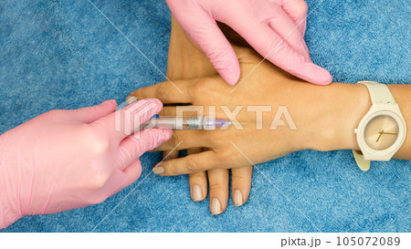 Biorevitalization hand skin rejuvenation for women 105072089