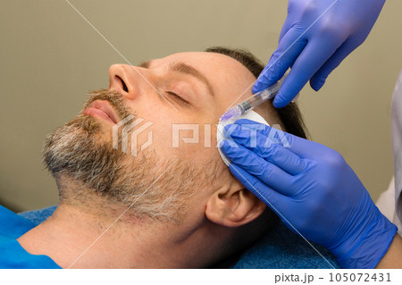 Mesotherapy rejuvenation injection for man Mesotherapy rejuvenation injection for man 105072431