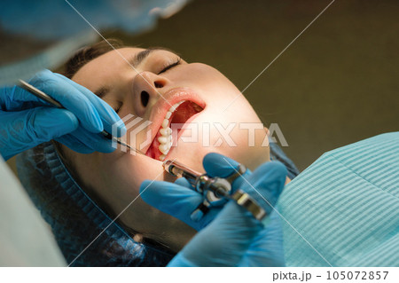 Anesthesia with lidocaine using carpool syringe Anesthesia with lidocaine using carpool syringe 105072857