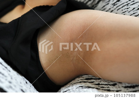剃毛後数日経過した女性の腋毛 剃毛後数日経過した女性の腋毛 105137988