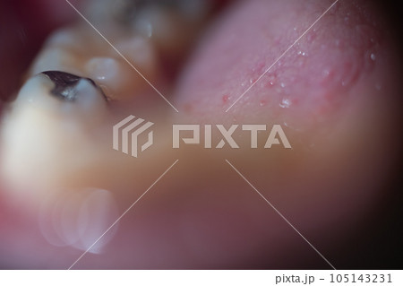 various various 105143231