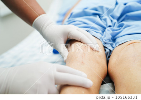 Doctor checking Asian elderly woman patient with scar knee replacement surgery in hospital. Doctor checking Asian elderly woman patient with scar knee replacement surgery in hospital. 105166331