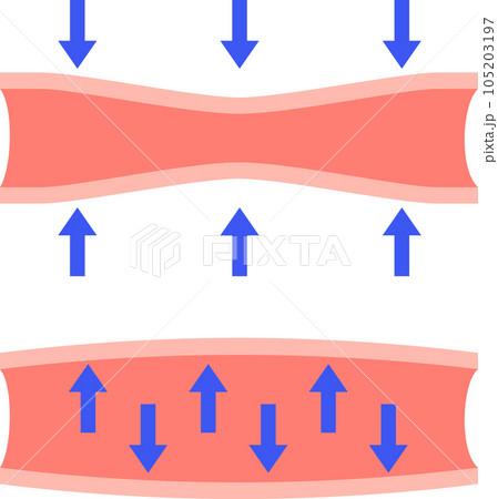 収縮する血管と膨張する血管 105203197