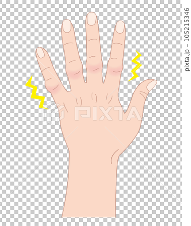 ブシャール結節 第二関節 腫れ 平面 イラスト カラー 透過 png 背景透明 105215346