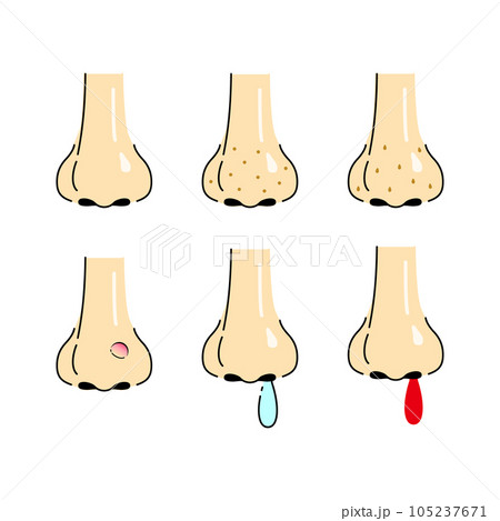 鼻セット 鼻セット 105237671