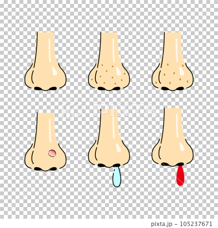 鼻セット 鼻セット 105237671