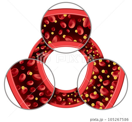 Glucose In The Blood 105267586