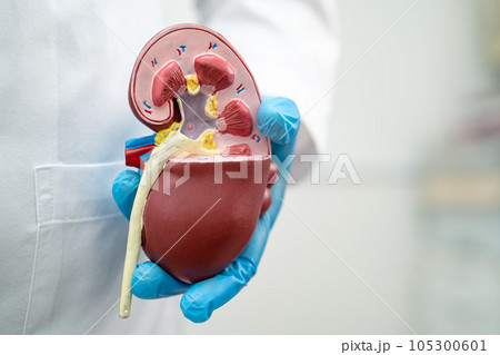Kidney disease, Chronic kidney disease ckd, Doctor hold model to study and treat in hospital. Kidney disease, Chronic kidney disease ckd, Doctor hold model to study and treat in hospital. 105300601