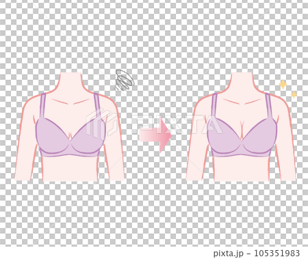 Breastfeeding Illustration of a body wearing a bra Before after 105351983