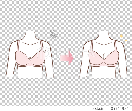 Breastfeeding Illustration of a body wearing a bra Before after 105351984