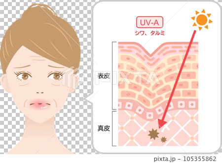 紫外線A波　しわ　たるみ　女性と肌の断面図 105355862