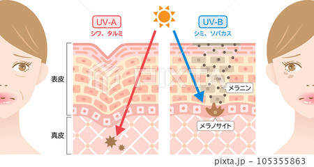 紫外線 UVAとUVB 女性と肌の断面図 紫外線 UVAとUVB 女性と肌の断面図 105355863