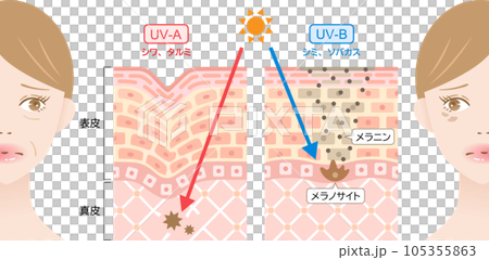 紫外線 UVAとUVB 女性と肌の断面図 紫外線 UVAとUVB 女性と肌の断面図 105355863