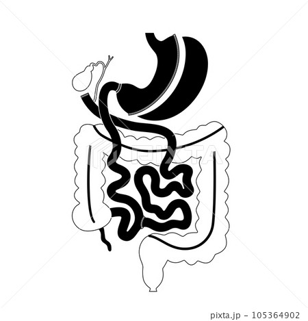 Biliopancreatic diversion procedure 105364902