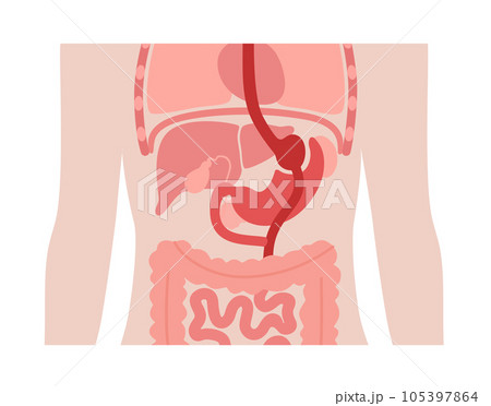 Gastric bypass surgery 105397864