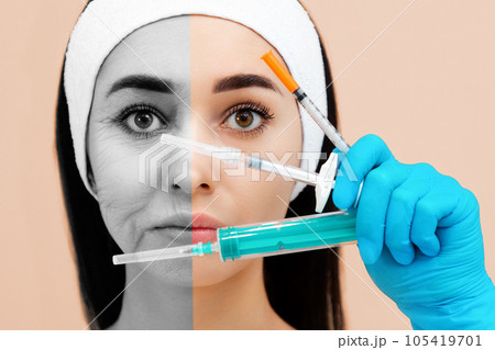 Results before and after cosmetic procedures. Close up portrait of a woman holding three syringes in hands near the face. Beige background. The concept of plastic surgery and rejuvenations injections Results before and after cosmetic procedures. Close up portrait of a woman holding three syringes in hands near the face. Beige background. The concept of plastic surgery and rejuvenations injections 105419701