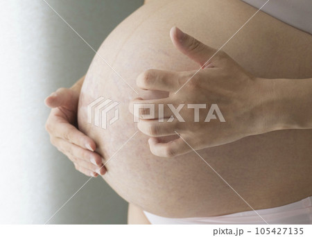 妊娠線が痒くてお腹を掻く手 105427135