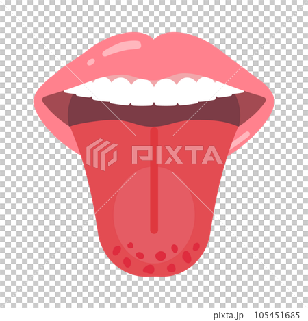 草莓舌 105451685