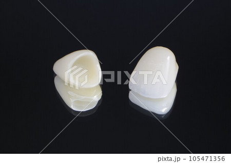 白くてきれいなセラミックの歯 105471356