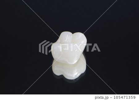 白くてきれいなセラミックの歯 白くてきれいなセラミックの歯 105471359