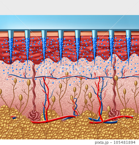 Microneedle Medical device 105481894