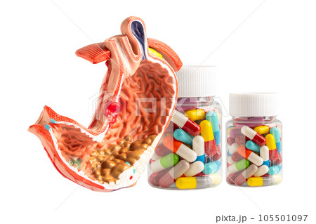 Gastritis medication drug for stomach ache, Gastroesophageal reflux disease GERD, medicine treatment. 105501097