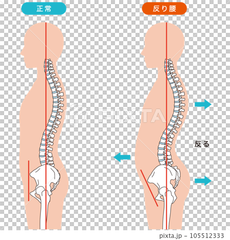 反り腰の姿勢　比較 105512333