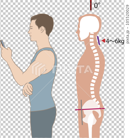 Angle of neck looking at smartphone and load, tilt 0 degrees Angle of neck looking at smartphone and load, tilt 0 degrees 105520029