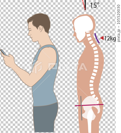 Angle of neck looking at smartphone and load, tilt 15 degrees Angle of neck looking at smartphone and load, tilt 15 degrees 105520030