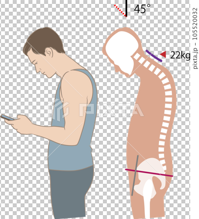 Angle of neck looking at smartphone and load, tilt 45 degrees 105520032