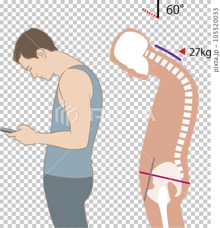 Angle of neck looking at smartphone and load, tilt 60 degrees 105520033