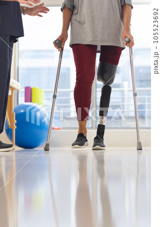 Midsection of caucasian physiotherapist and senior woman with artificial leg walking with crutches 105523692