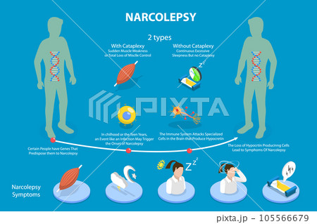 3D Isometric Flat Vector Conceptual Illustration of Narcolepsy 105566679