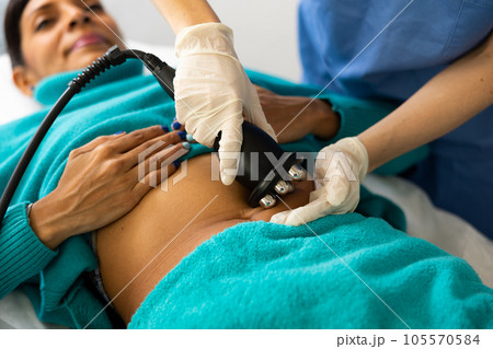 Woman receiving radio frequency abdomen lifting procedure 105570584