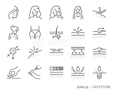Acne icon set. It included pimple, facial, zits, inflammation and more icons. Editable Vector Stroke. 105577296