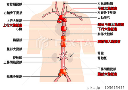 首から腰までのシンプルな大動脈概略図 首から腰までのシンプルな大動脈概略図 105615435