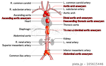 首から腰までのシンプルな大動脈概略図 105615446