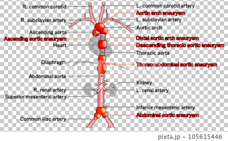 Simple aorta schematic from neck to waist 105615446