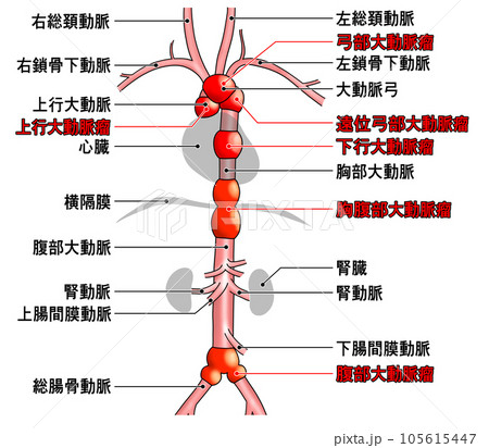 首から腰までのシンプルな大動脈概略図 首から腰までのシンプルな大動脈概略図 105615447