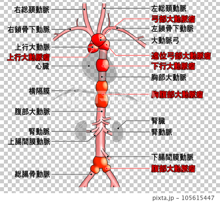 首から腰までのシンプルな大動脈概略図 首から腰までのシンプルな大動脈概略図 105615447