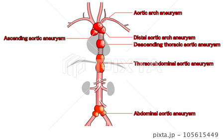 首から腰までのシンプルな大動脈概略図 105615449