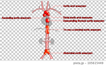首から腰までのシンプルな大動脈概略図 105615449